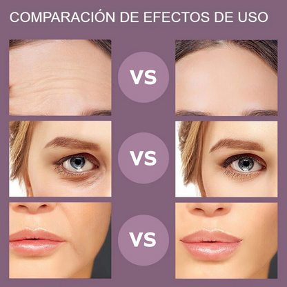 Microcorreinte facial - 50% DESCUENTO