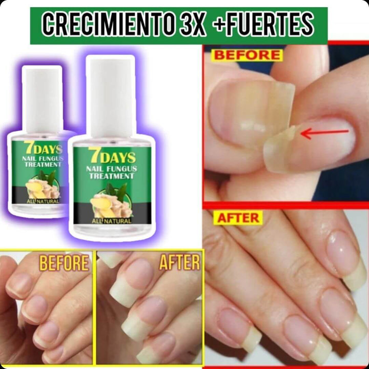 NAILREVITA PRO™ -FORTALEZA Y CRECIMIENTO SUPERIOR PARA TUS UÑAS - 50% DESCUENTO