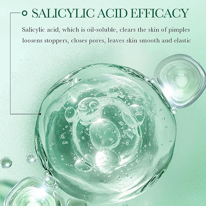 ACNÉ REMOVAL