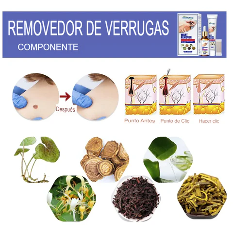 REMOVEDOR DE VERRUGAS - 50% DESCUENTO