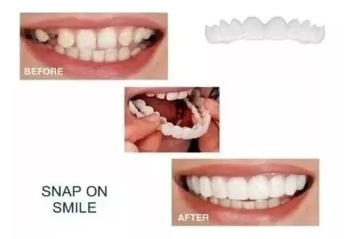 Moldura Sonrisa Smile- 50% DESCUENTO