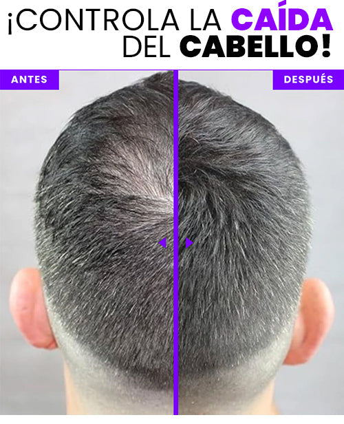 Corrector de canas y espacios Bunee Profesional - 50% DE DESCUENTO