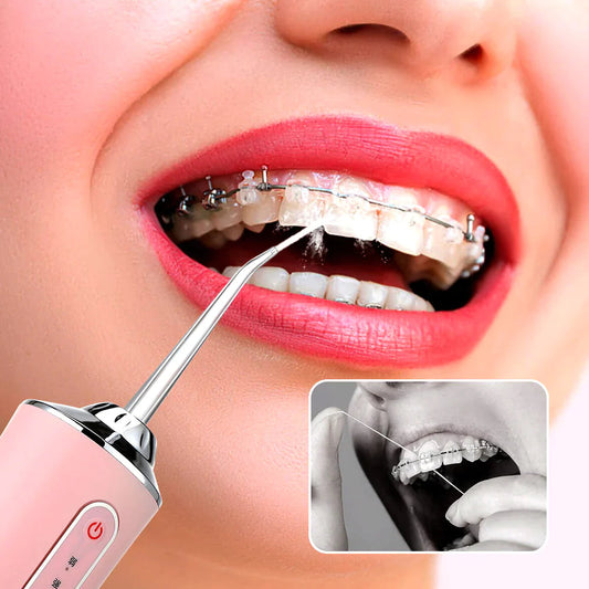 Irrigador OralFlow® | Dientes Blancos & Higiene Profunda + Accesorios Grátis  - 50% DE DESCUENTO