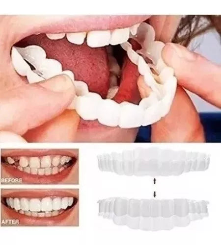 Moldura Sonrisa Smile- 50% DESCUENTO