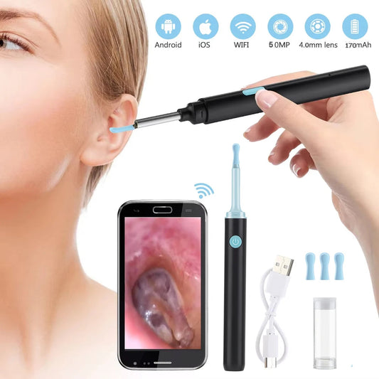 Otocam™ Limpieza de Oídos Inteligente - 50% DESCUENTO HOY